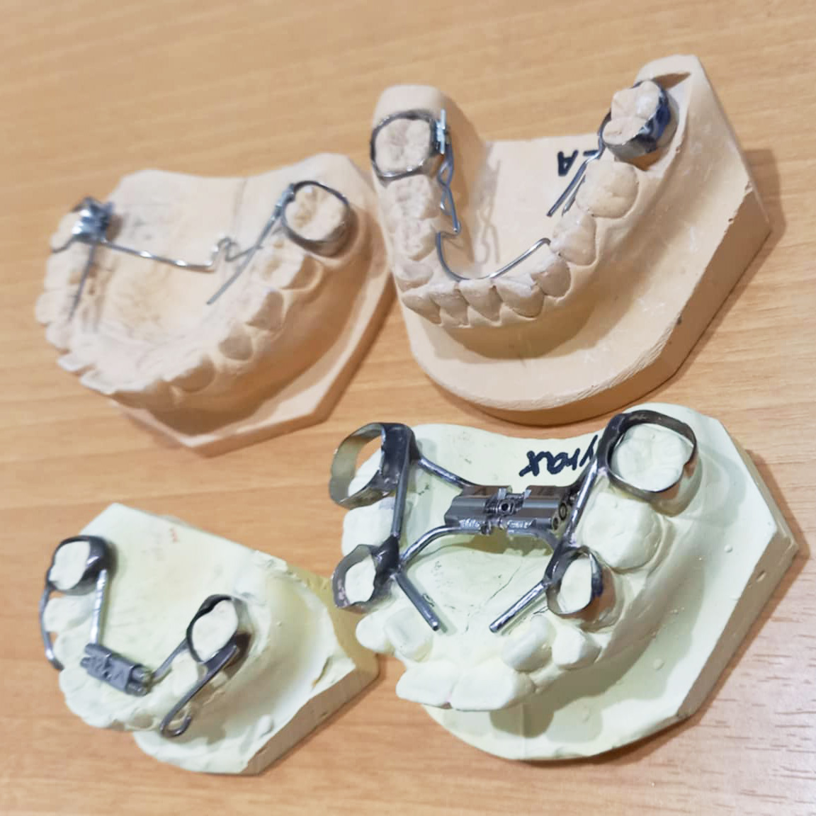 患者それぞれに合った矯正治療を提案する