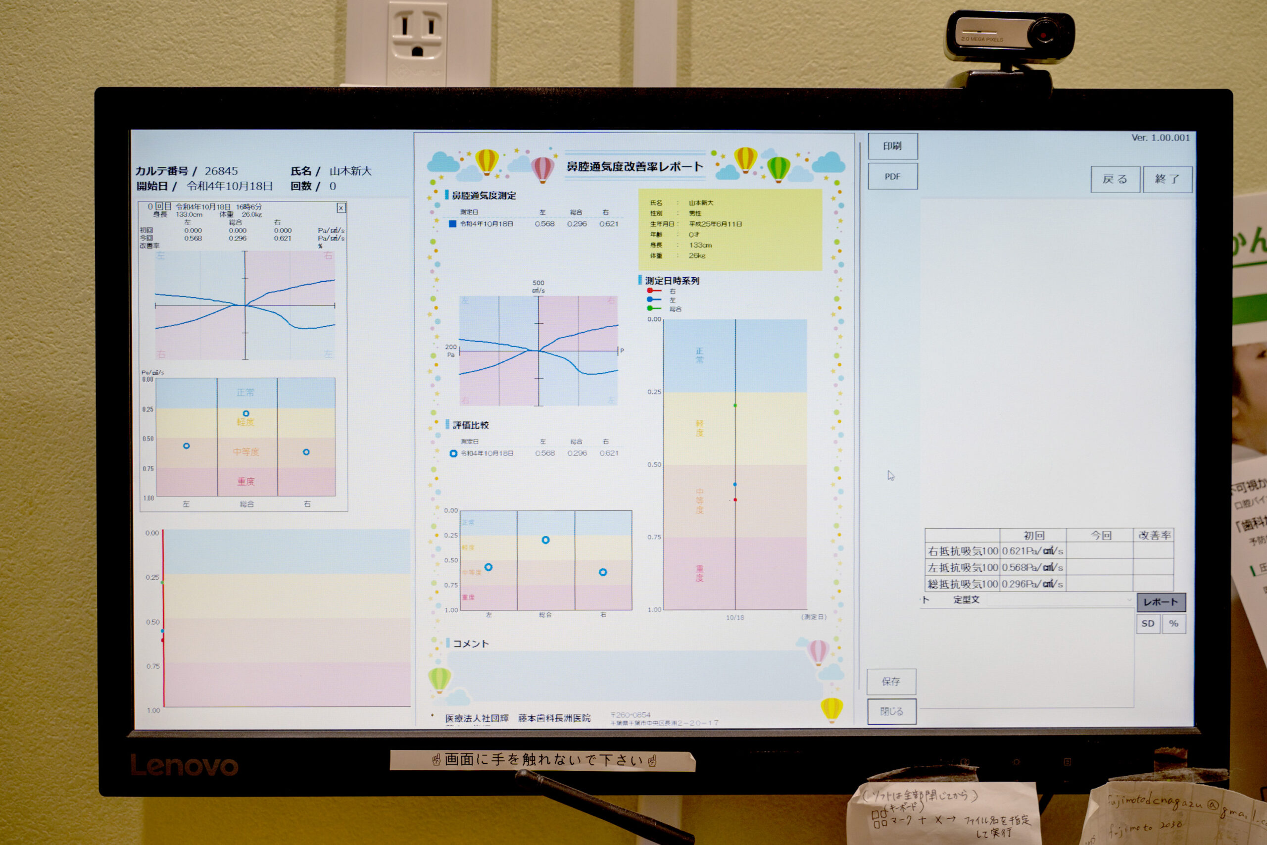 顎顔面矯正で鼻の通りがよくなることを確認している